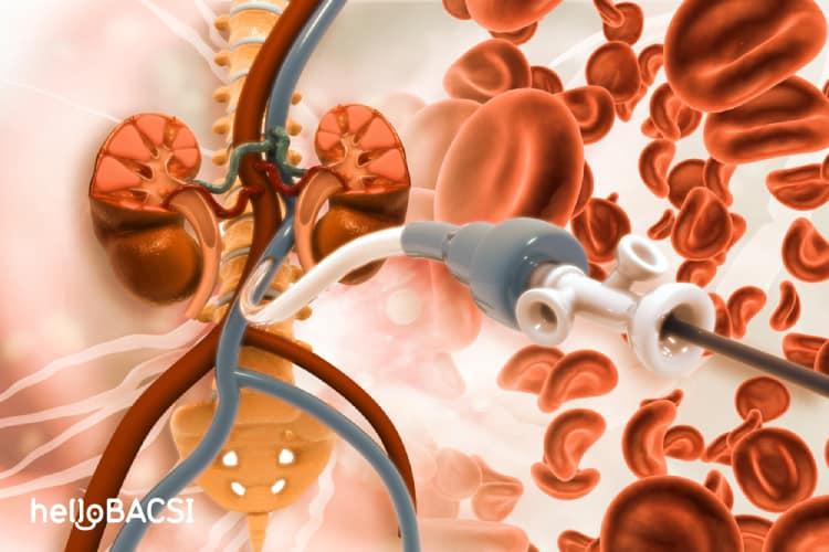 dong-mach-ngoai-bien-pad