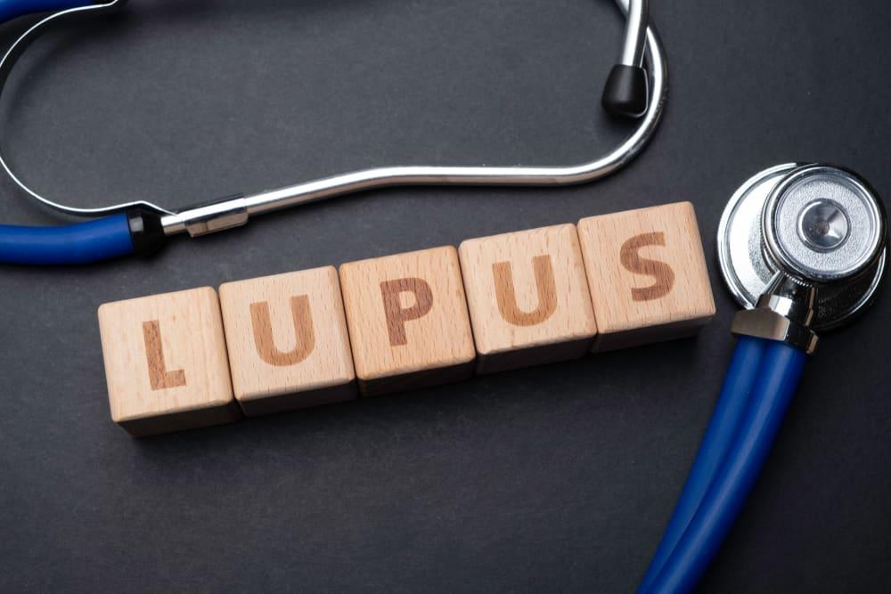 Lupus ban đỏ