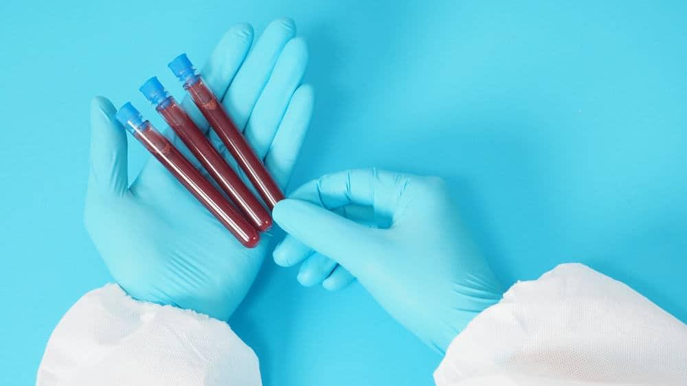 Cholesterol và triglycerid