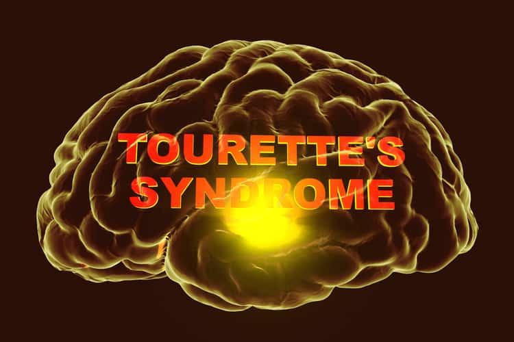 Hội chứng Tourette