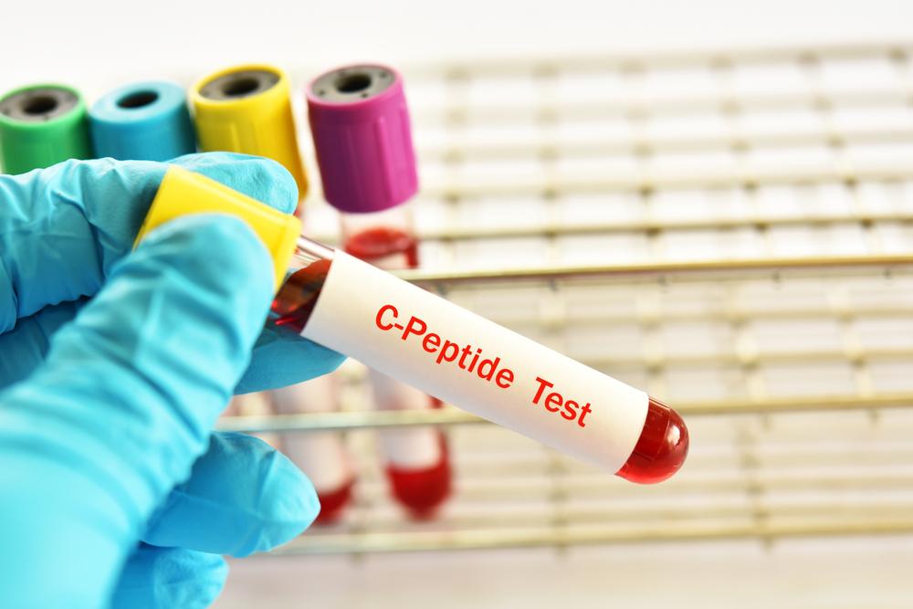 c-peptide