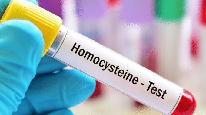 homocysteine