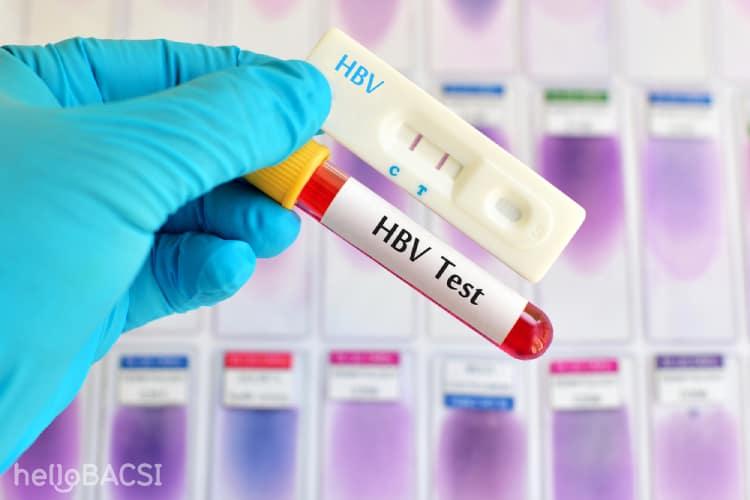 Xét nghiệm viêm gan B