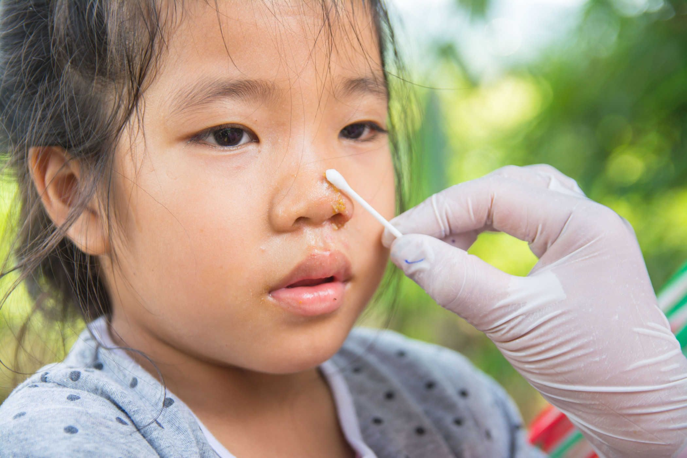 Xử lý thế nào khi mũi bị đau?