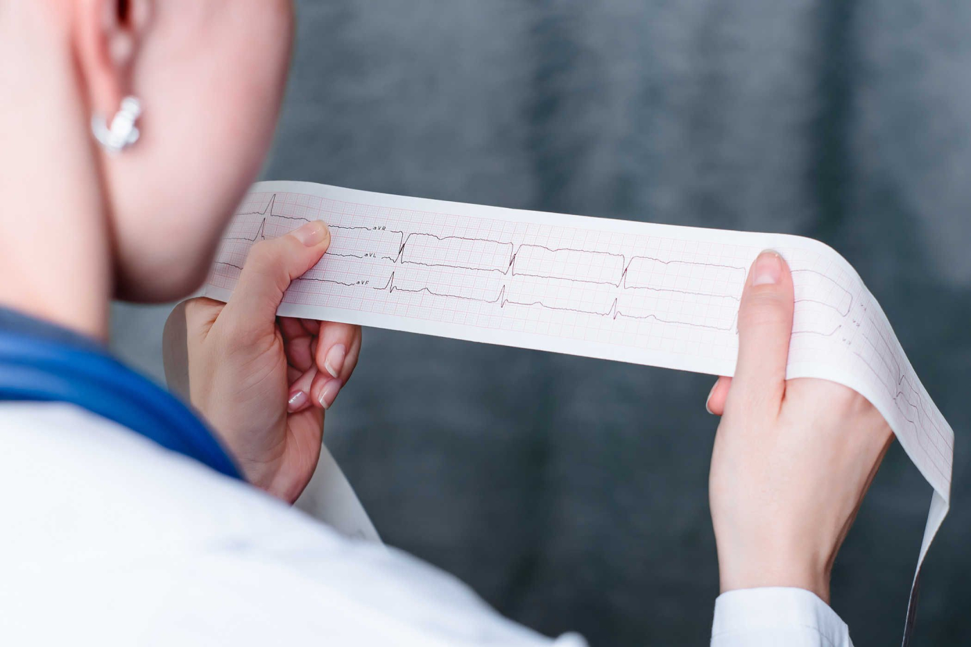 Tổng quan về bệnh tim