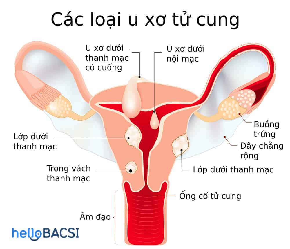 u-xo-tu-cung
