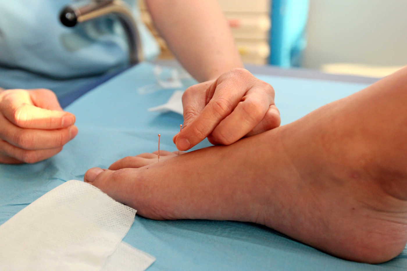 Câu trả lời cho việc thụ thai nhờ châm cứu