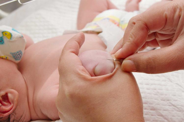 Tìm hiểu về bệnh thiếu máu Diamond Blackfan