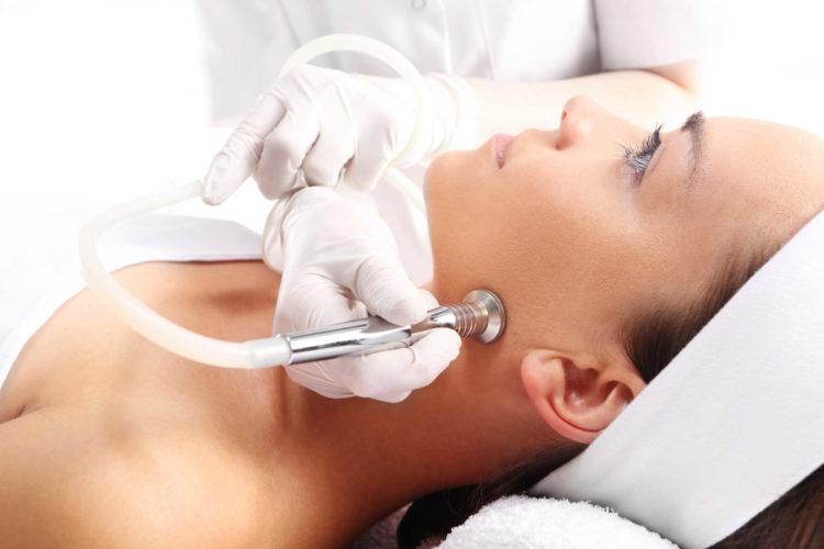 "Diệt giặc" mụn đầu đen triệt để