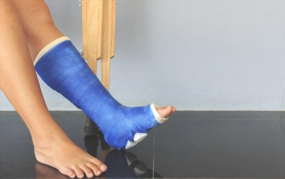 Gãy mắt cá chân