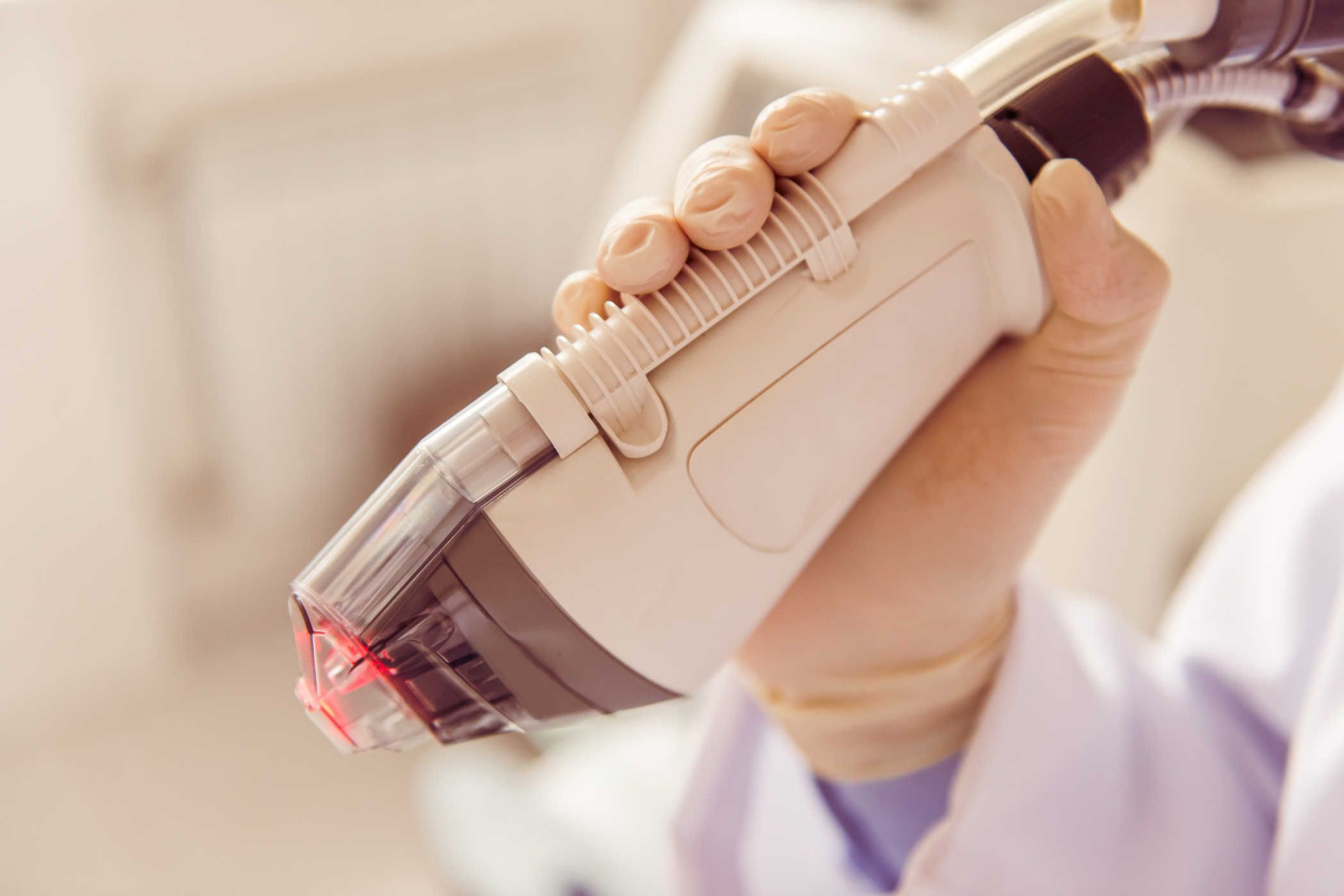 5 khác biệt giữa laser bóc tách và laser không bóc tách