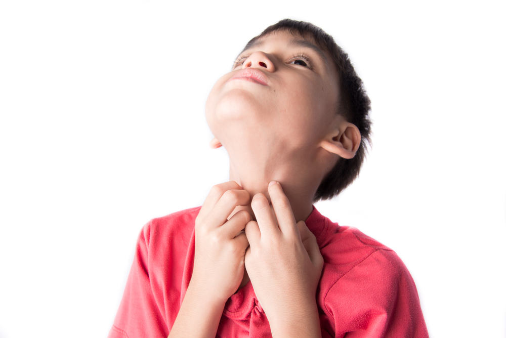 Vết cắn và đốt