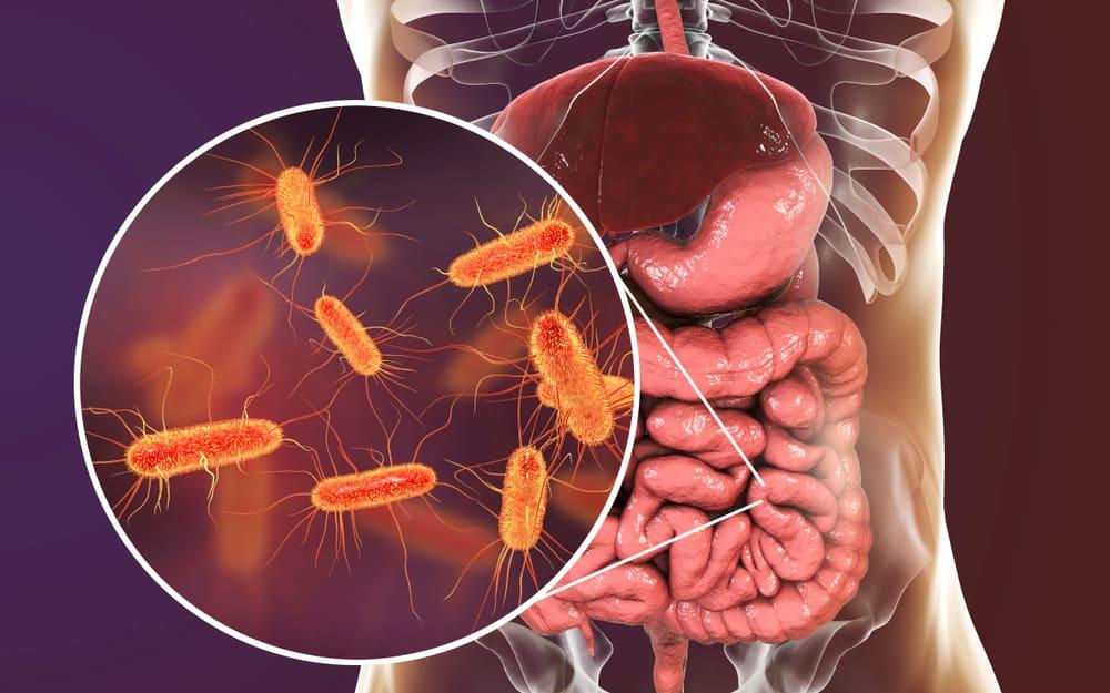 Vi khuẩn E. coli gây bệnh thế nào? Các triệu chứng và cách phòng ngừa