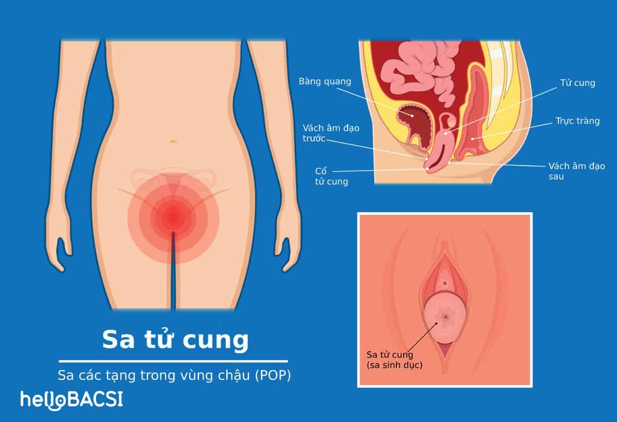 sa-tu-cung