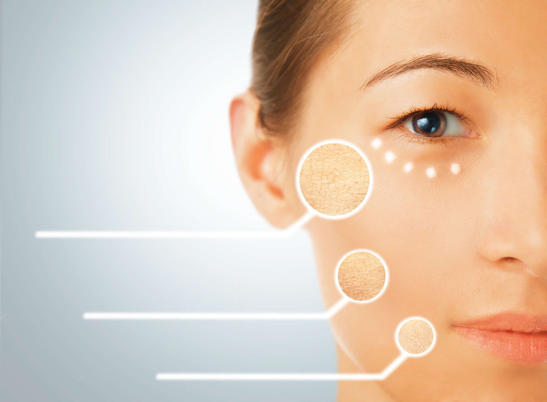 Physogel® Al Cream