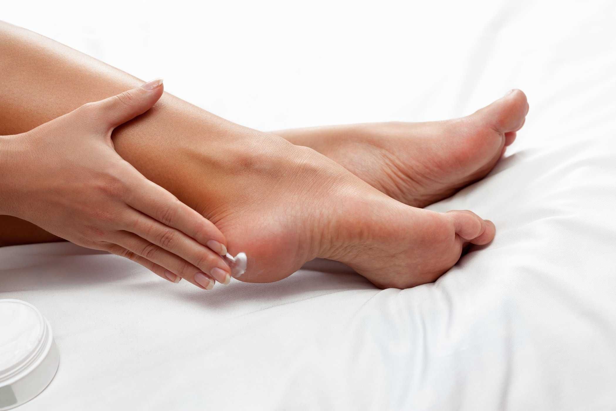 8 mẹo hữu hiệu giúp bạn trị nứt gót chân
