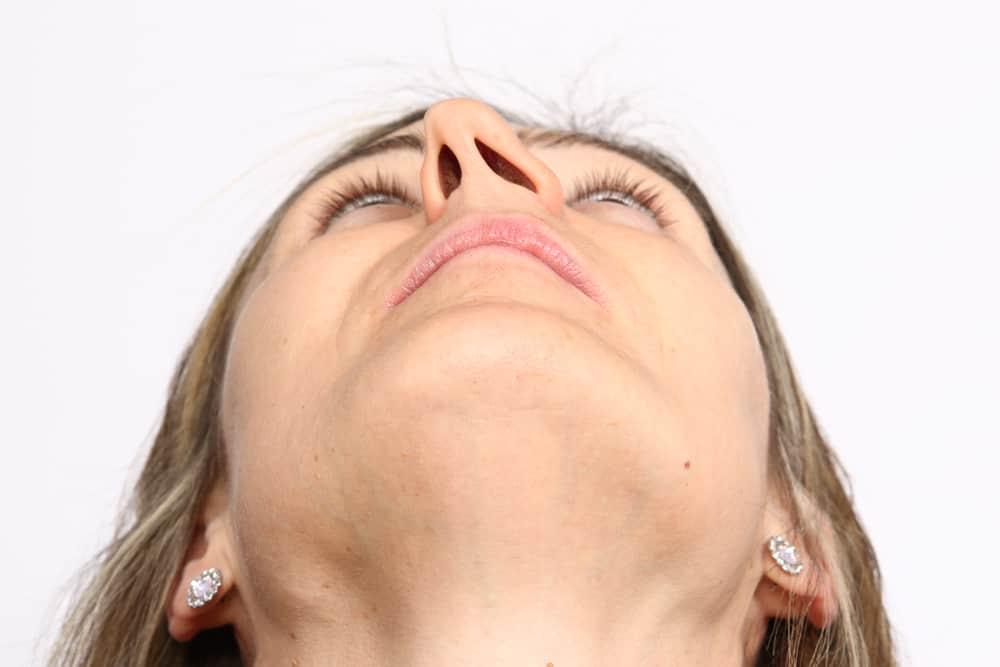 lech-vach-ngan-mui