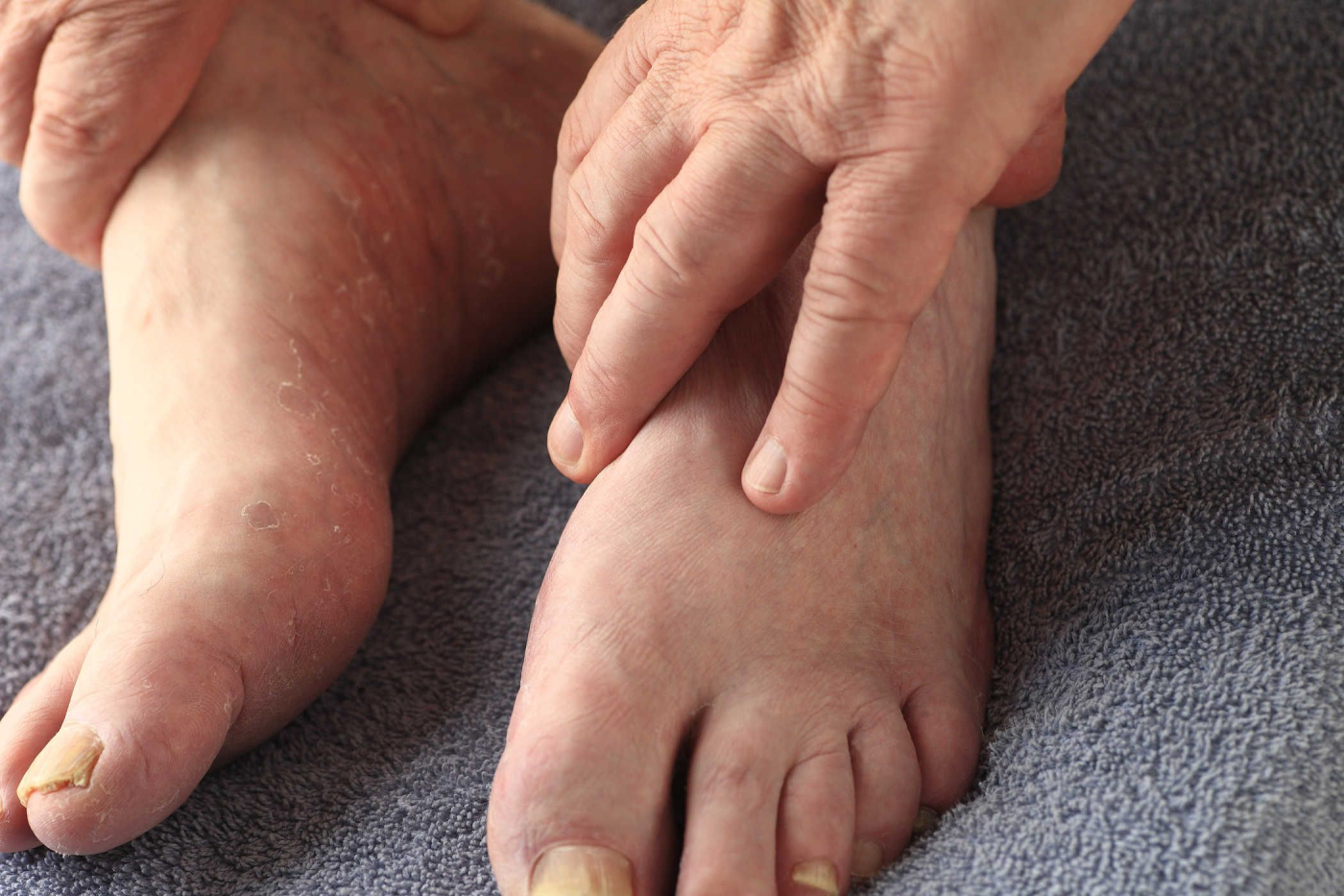 Ketoconazole Daewon®