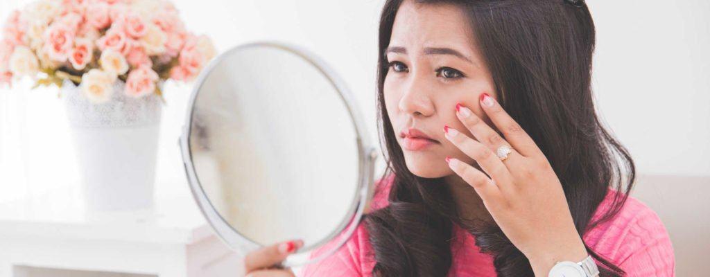 Lỗ chân lông to hai bên má: Nguyên nhân & Cách chữa trị