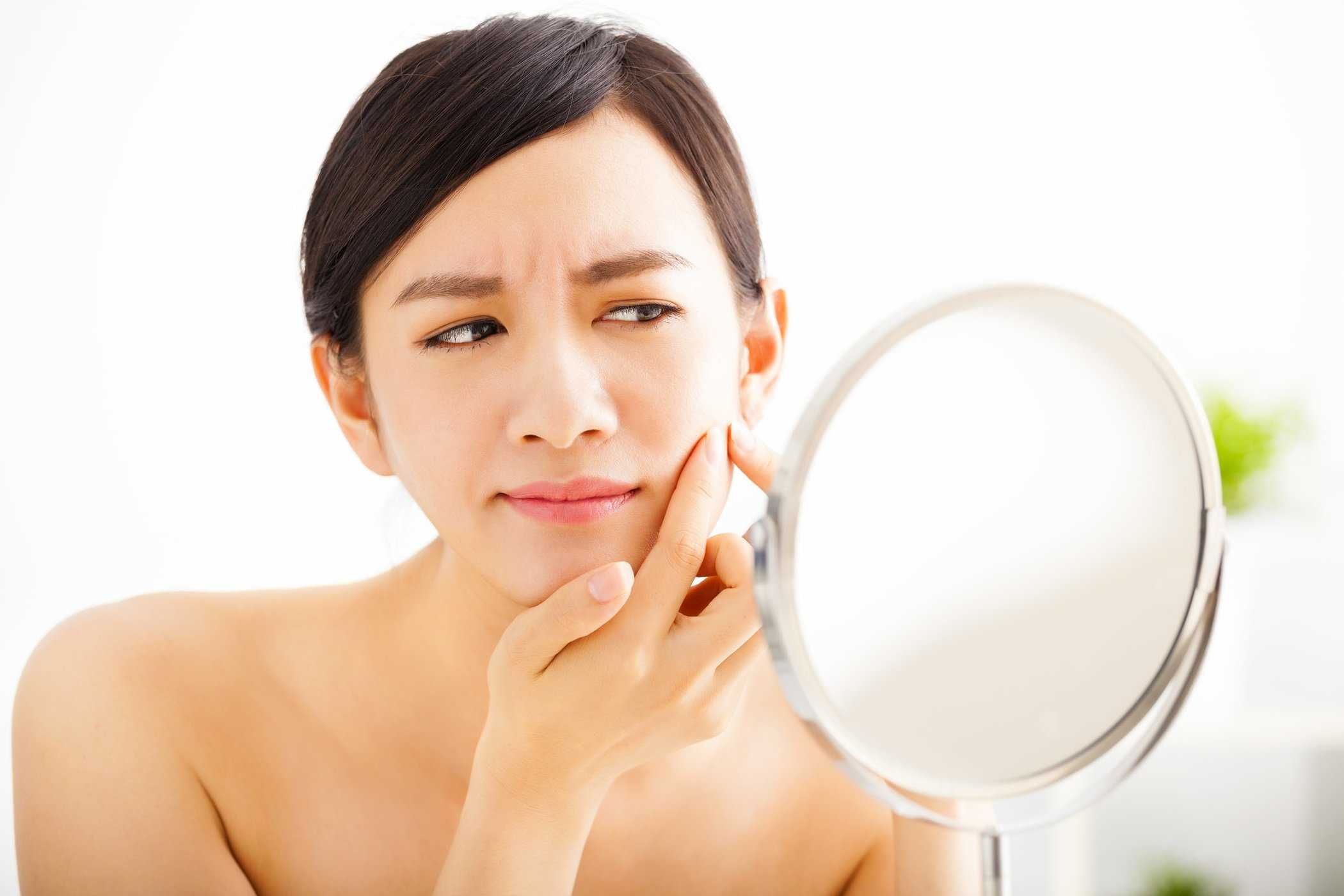 5 cách hiệu quả điều trị sẹo lõm do mụn trứng cá