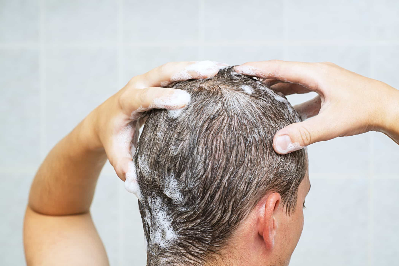 Selsun® Gold/Selsun® Suspension