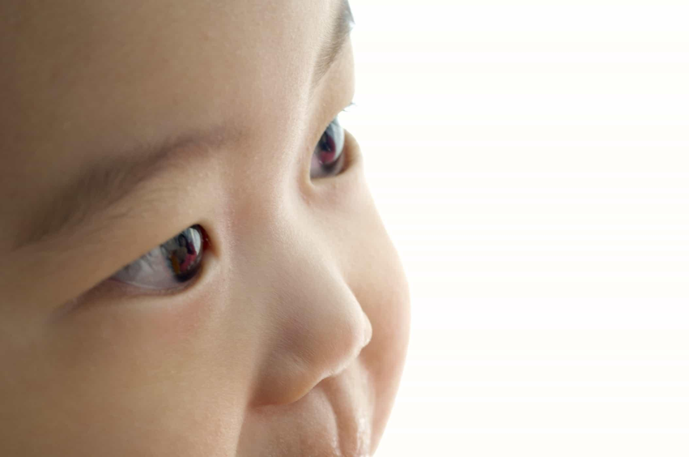 Bệnh võng mạc ở trẻ sinh non