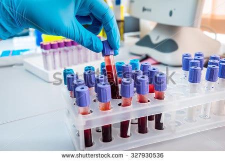 Tổng phân tích tế bào máu