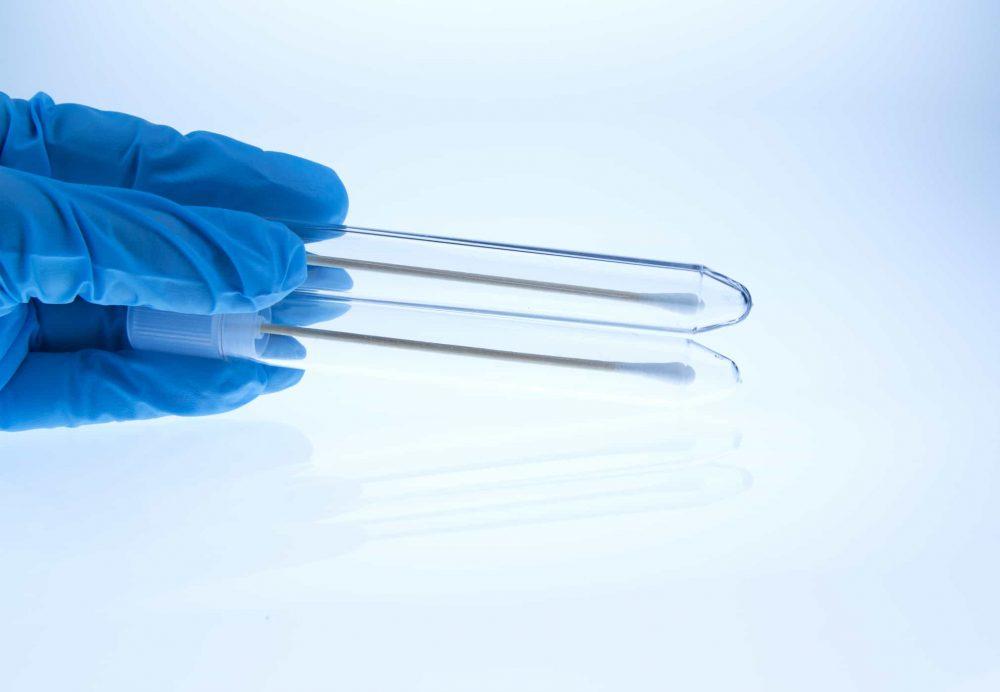 Chưa quan hệ tình dục có cần xét nghiệm tế bào cổ tử cung (Pap)?