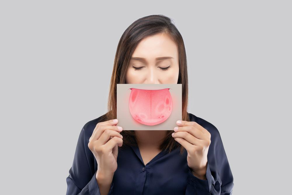 Bệnh bạch sản: Triệu chứng nào là dấu hiệu cảnh báo ung thư?