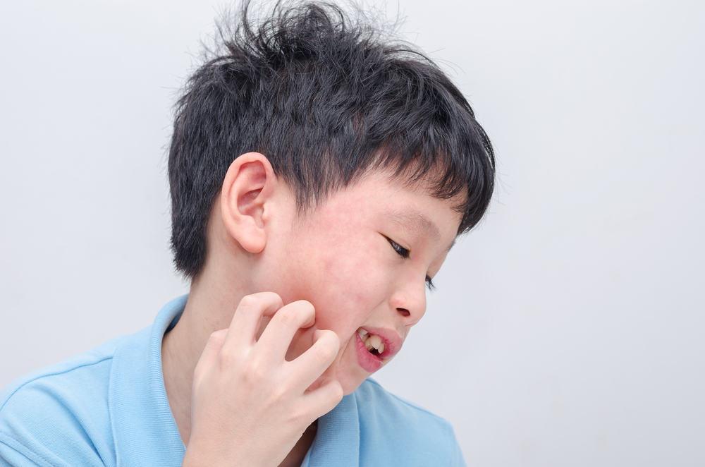 phan-biet-benh-soi-va-benh-ban-dao-o-tre-nho