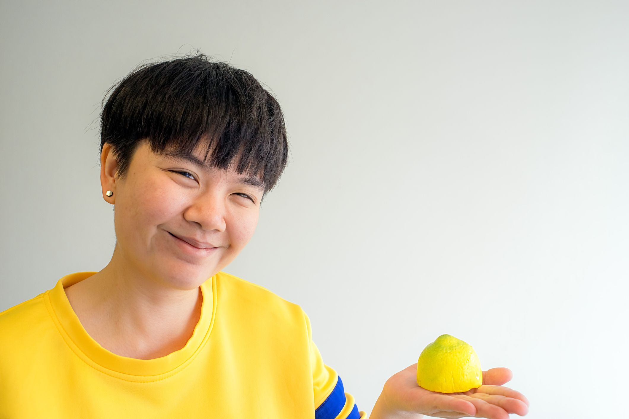 Hội chứng không nhạy cảm androgen