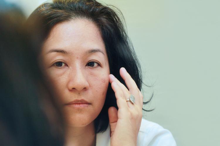 Phương pháp trị sẹo trên mặt hiệu quả