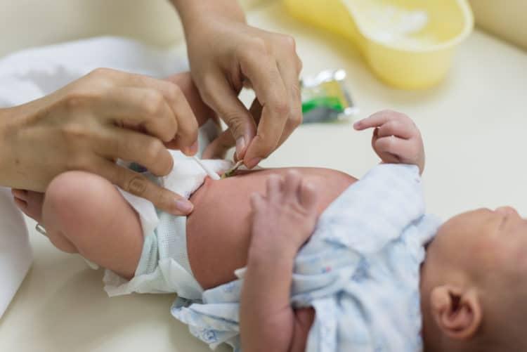 4 cách đơn giản giúp bạn chăm sóc rốn cho trẻ sơ sinh