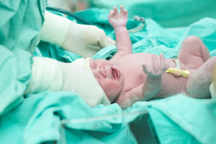 Trẻ sơ sinh hít nước ối phân su nguy hiểm không? Bác sĩ xử lý thế nào?