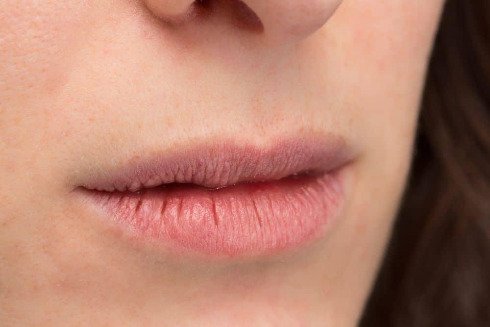 10 cách trị môi khô nứt nẻ tại nhà nhanh-gọn-lẹ