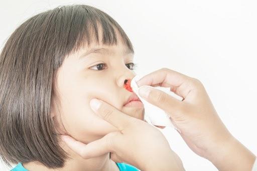 Trẻ bị chảy máu mũi 1 bên: Nguyên nhân, cách khắc phục và ngừa tái phát