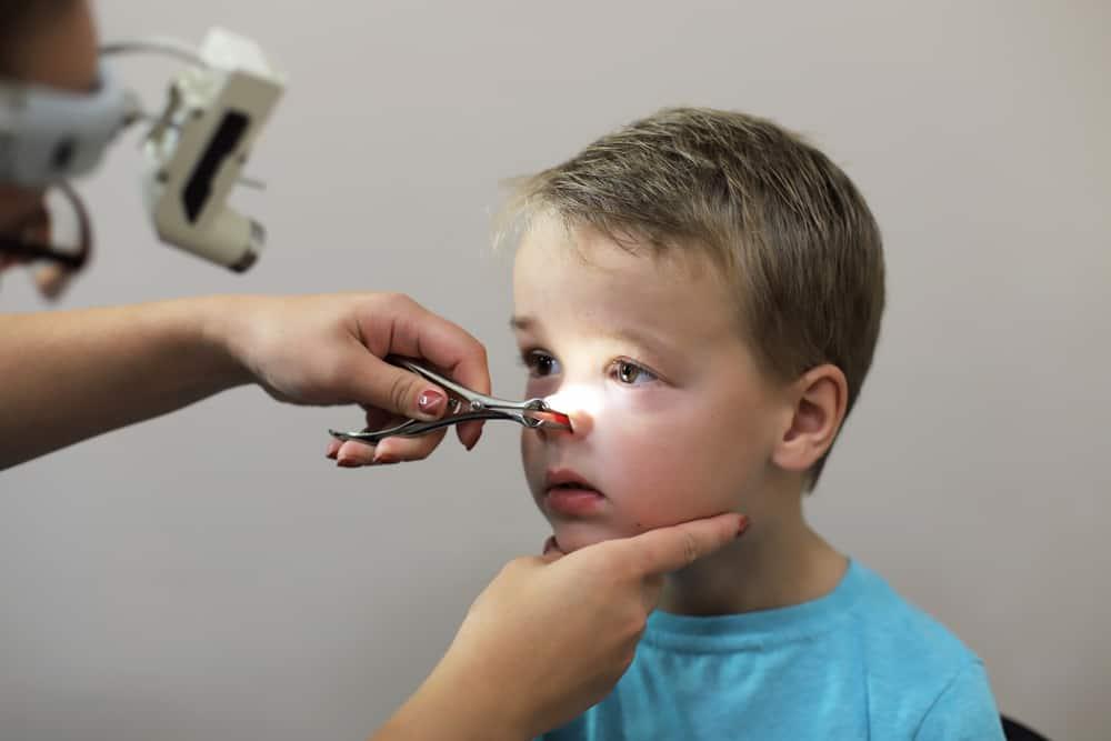 Viêm VA mạn tính