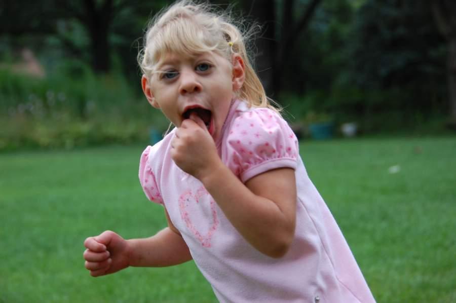 Hội chứng Seckel