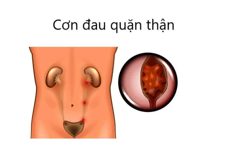 con-dau-quan-than