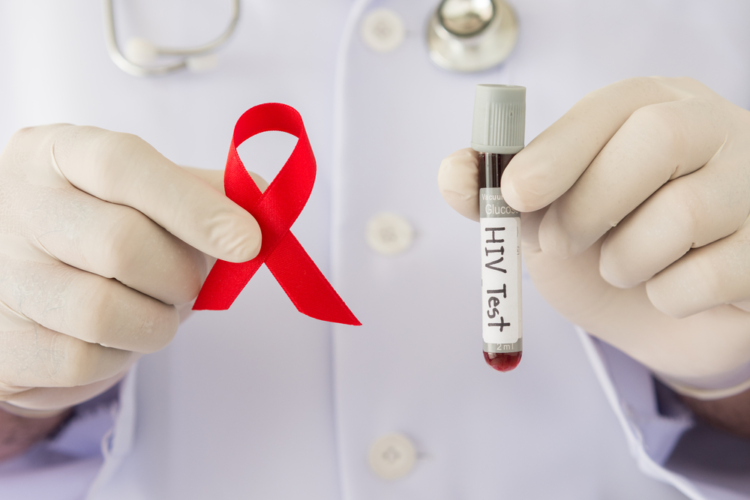 12 dấu hiệu nhiễm HIV sau 2-4 tuần dễ nhầm lẫn với các bệnh khác
