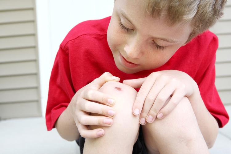5 dấu hiệu nhiễm trùng vết thương cần lưu ý để chữa trị kịp thời