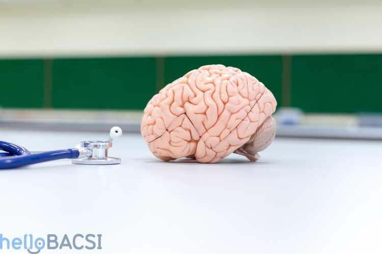 Phẫu thuật phình động mạch não