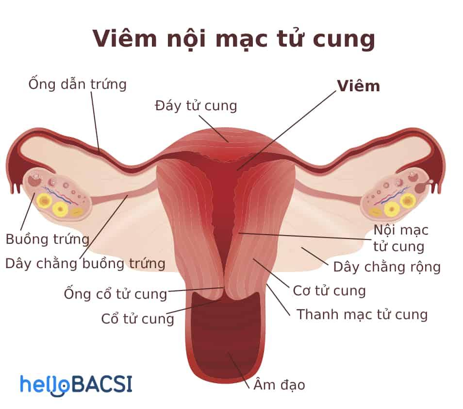 viem-noi-mac-tu-cung