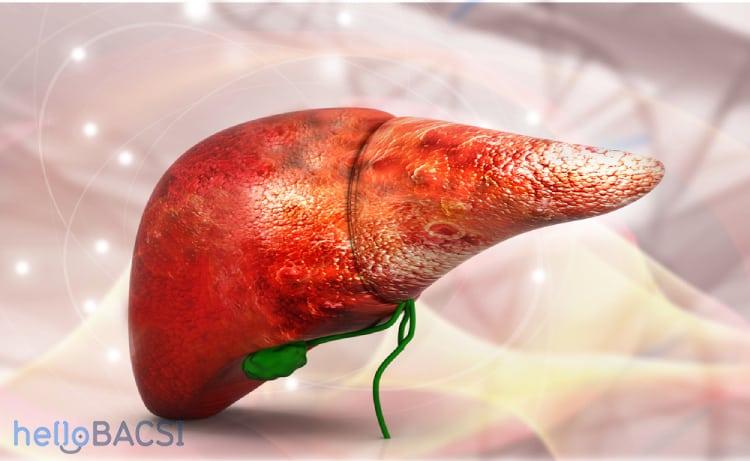 Chỉ số MELD: Bạn có thực sự cần ghép gan?