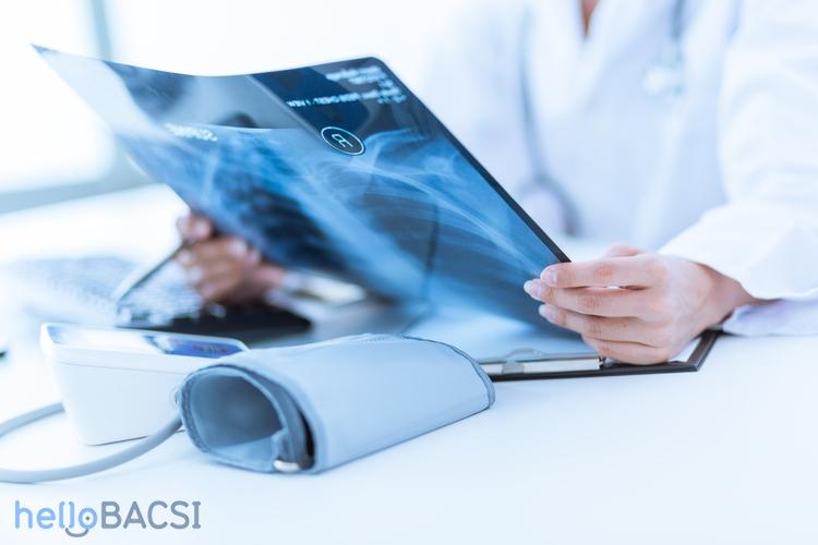 Chụp X-quang trong COPD có hiệu quả?