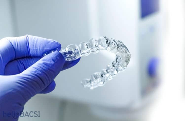 Miếng bảo vệ răng miệng có nhiều tác dụng hơn bạn tưởng