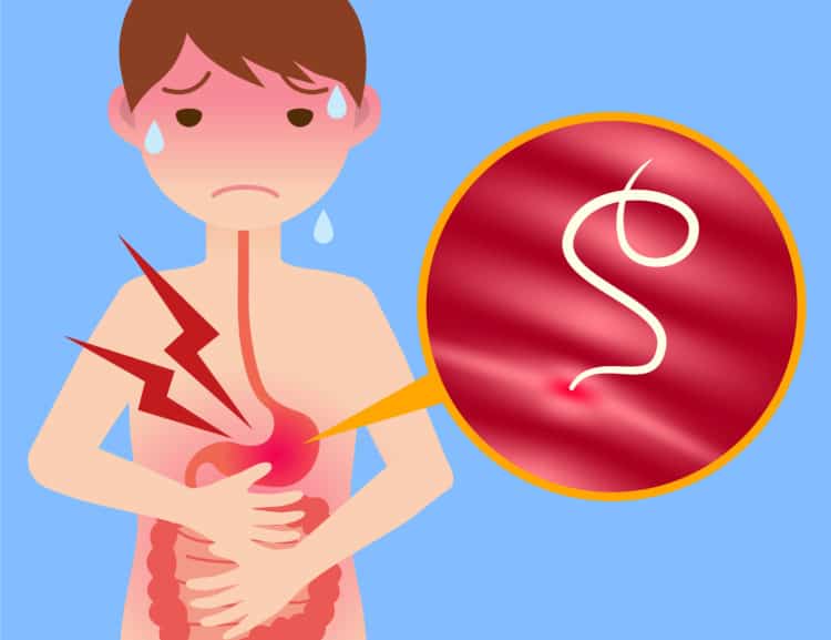 [Infographic] Phòng chống bệnh giun sán