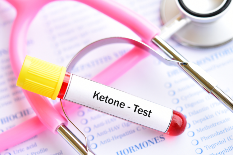 Hiểu biết về ketone để ngừa bệnh tiểu đường