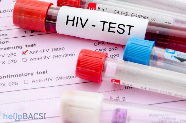 xet-nghiem-hiv