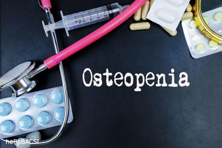 5 điều bạn cần biết về tình trạng osteopenia